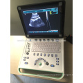 Christmas Promotion!! MSLPU34-I portable PC based 3d ultrasound scanner